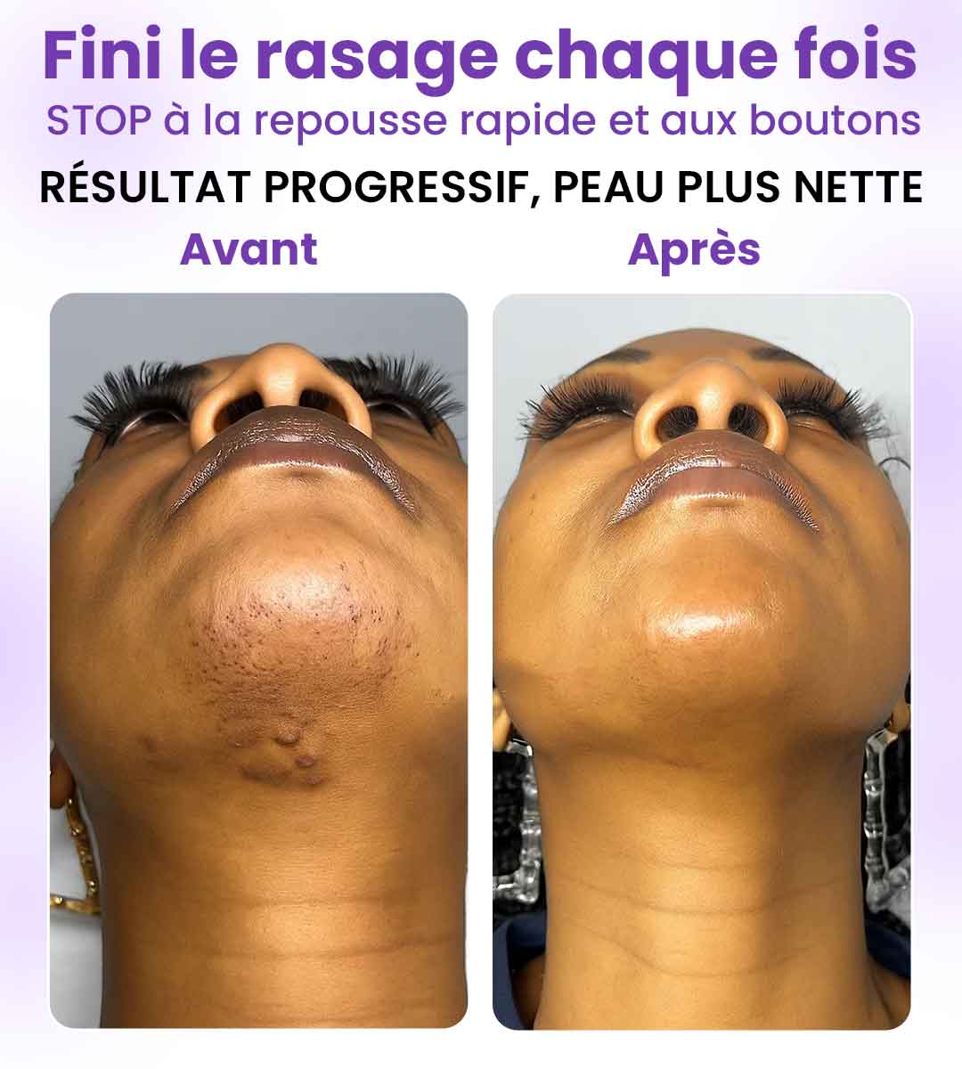 Un rasage plus net, jusqu'au moindre poil
